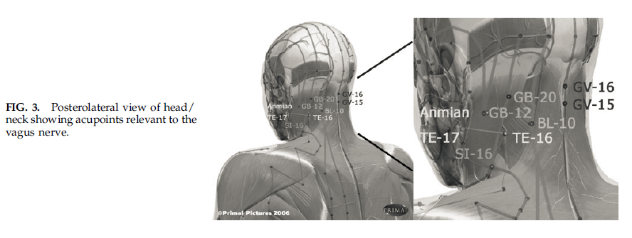 Alternative medicine and acupuncture treatment of fibromyalgia FM in London Ontario