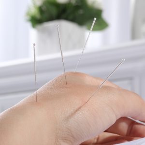 hand with acupuncture needles for arthritis treatment